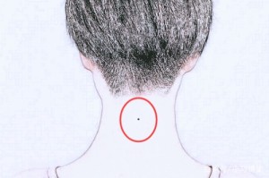 后脖子上有颗痣的男人有什么意义吗