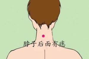 后脖有痣的女人有福吗