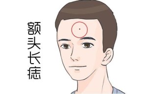 额头有痣的男人好不好
